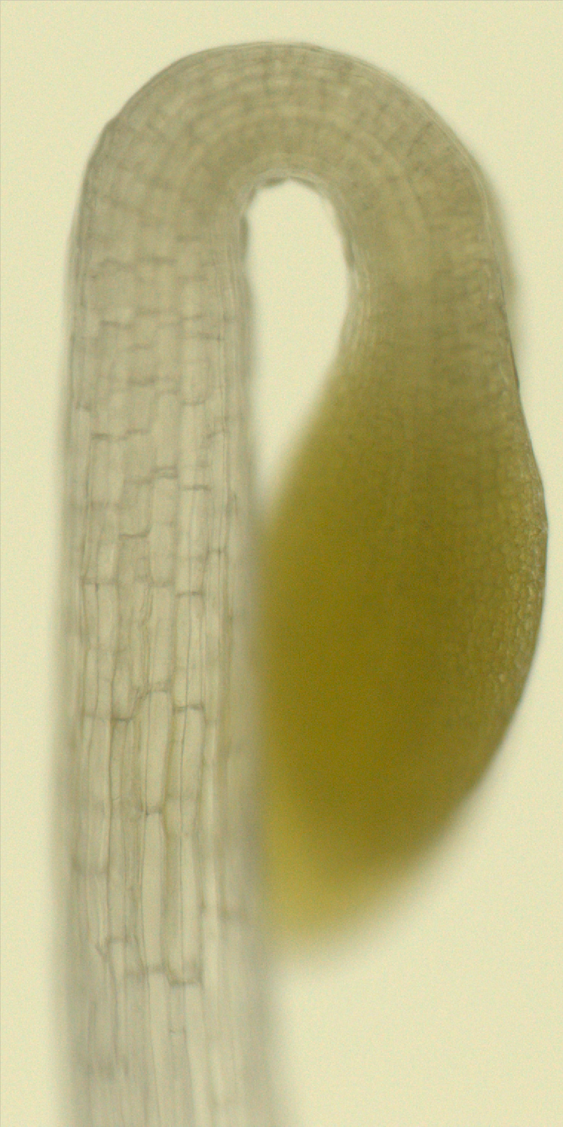 Brightfield micrograph of an Arabidopsis seedling apical hook